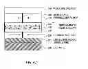 Fig. 08 - Feromagnetically coupled magnetic recording media
