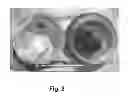 Fig. 03 - Metal Accumulation Inhibiting And Performance Enhancing Supplement And A System For Delivering The Supplement