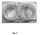 Fig. 04 - Metal Accumulation Inhibiting And Performance Enhancing Supplement And A System For Delivering The Supplement