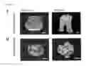 Fig. 02 - Dental implant and method for producing same
