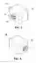 Fig. 03 - Milling block with orthodontic auxiliary