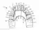 Fig. 01 - Lingual orthodontic appliance with removable section