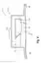 Fig. 06 - Reduced-friction buccal tube and method of use