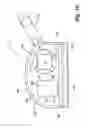 Fig. 19 - Reduced-friction buccal tube and method of use