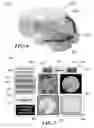 Fig. 07 - Method and system for quantitative assessment of verbal recognition memory