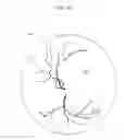 Fig. 08 - Model newborn human eye and face manikin