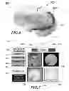 Fig. 07 - Method and system for quantitative assessment of functional impairment
