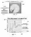 Fig. 40 - Method and system for quantitative assessment of functional impairment