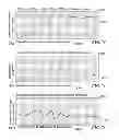 Fig. 41 - Method and system for quantitative assessment of functional impairment
