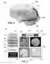 Fig. 07 - Method and system for quantitative assessment of visual motor response