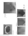 Fig. 02 - Systems and methods for imaging and processing tissue