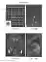 Fig. 20 - Systems and methods for imaging and processing tissue
