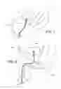 Fig. 02 - Detection of luminal urinary catheter colonization