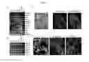 Fig. 09 - Differentiating induced pluripotent stem cells into glucose-responsive, insulin-secreting progeny