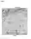 Fig. 02 - Biological Pacemaker