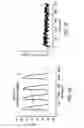 Fig. 07 - Biological Pacemaker