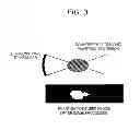 Fig. 04 - TISSUE MIMICKING PHANTOM AND CALIBRATION DEVICE