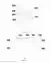 Fig. 04 - METHOD OF IMPROVING THE YIELD OF A SEMICONDUCTOR DEVICE