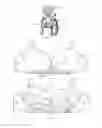 Fig. 02 - Adjustable breast positioning systems for women's garments and related methods