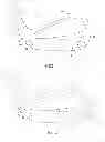 Fig. 02 - Progressive iron set
