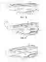 Fig. 08 - Progressive iron set