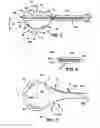 Fig. 03 - Personal athletic training device