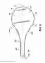 Fig. 05 - Personal athletic training device