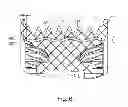 Fig. 07 - Pulley ring