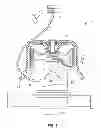 Fig. 02 - Methods for extracting platelet-rich plasma for therapeutic injection