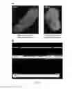 Fig. 06 - Methods and compositions for diagnosing and treating cancer