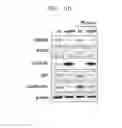 Fig. 09 - RADIATION EXPOSURE DIAGNOSTIC MARKER IGFBP-5, COMPOSITION FOR RADIATION EXPOSURE DIAGNOSIS BY MEASURING THE EXPRESSION LEVEL OF THE MARKER, RADIATION EXPOSURE DIAGNOSTIC KIT COMPRISING THE COMPOSITION, AND METHOD FOR DIAGNOSING RADIATION EXPOSURE USING THE MARKER