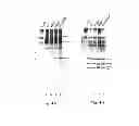 Fig. 06 - METHOD OF PRODUCING FACTOR VIII PROTEINS BY RECOMBINANT METHODS
