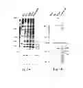 Fig. 07 - METHOD OF PRODUCING FACTOR VIII PROTEINS BY RECOMBINANT METHODS