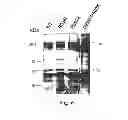 Fig. 08 - METHOD OF PRODUCING FACTOR VIII PROTEINS BY RECOMBINANT METHODS