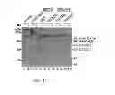 Fig. 12 - METHOD OF PRODUCING FACTOR VIII PROTEINS BY RECOMBINANT METHODS