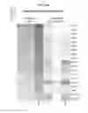 Fig. 102 - Gene expression signatures of neoplasm responsiveness to therapy