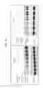 Fig. 12 - Gene expression signatures of neoplasm responsiveness to therapy