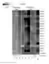 Fig. 52 - Gene expression signatures of neoplasm responsiveness to therapy