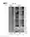 Fig. 53 - Gene expression signatures of neoplasm responsiveness to therapy