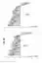 Fig. 56 - Gene expression signatures of neoplasm responsiveness to therapy