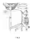 Fig. 03 - METHOD OF TREATING DISEASE BY AURICULAR ANESTHESIA OF CRANIAL NERVES