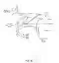 Fig. 07 - METHOD OF TREATING DISEASE BY AURICULAR ANESTHESIA OF CRANIAL NERVES