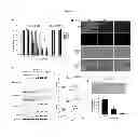 Fig. 02 - METHOD FOR INHIBITING EZH2 EXPRESSION IN BREAST CANCER CELLS
