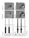 Fig. 04 - Beta 2 adrenoceptor antagonists for treating orthostatic hypotension