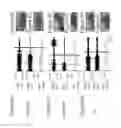 Fig. 06 - Beta 2 adrenoceptor antagonists for treating orthostatic hypotension