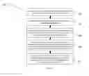 Fig. 02 - Programmable segmented volumetric modulated arc therapy for respiratory coordination