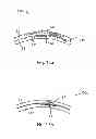 Fig. 12 - mTMS coil device with overlapping coil windings