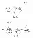 Fig. 13 - mTMS coil device with overlapping coil windings