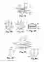 Fig. 06 - Implants, tools, and methods for treatment of pelvic conditions