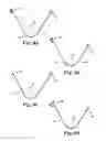 Fig. 07 - Implants, tools, and methods for treatment of pelvic conditions